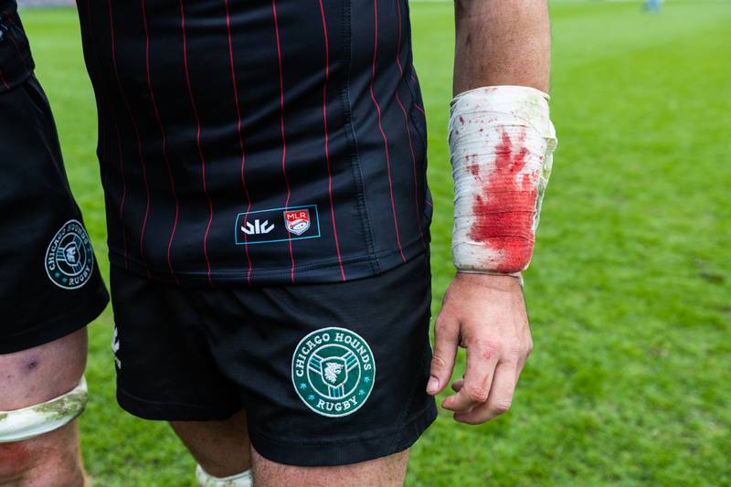 Chicago Hounds' flanker Maclean Jones’ athletic tape did double duty during the game when he got a bloody nose while playing against the New Orleans Gold, at Seat Geek Stadium in Bridgeview, on Sunday April 23, 2023.