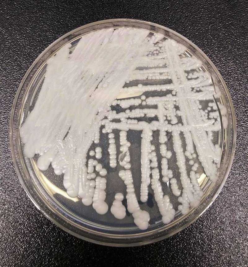 FILE - This undated photo made available by the Centers for Disease Control and Prevention shows a strain of Candida auris cultured in a petri dish at a CDC laboratory. In a CDC paper published by the Annals of Internal Medicine on Monday, March 20, 2023, U.S. cases of the dangerous fungus tripled over just three years, and more than half of states have now reported it. (Shawn Lockhart/Centers for Disease Control and Prevention via AP, File)