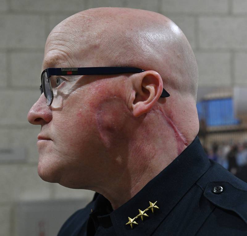 Glen Ellyn Police Chief Philip Norton shows a sunscreen dispenser in the locker room on Wednesday, June 12, 2024 in Glen Ellyn. Norton, who has been treated for two kinds of skin cancer, has had the sunscreen dispensers installed at the department, and officers have received bucket hats.